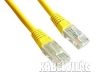 Gembird UTP CAT5e patch kábel 1.5m, sárga (PP12-1.5M/Y)